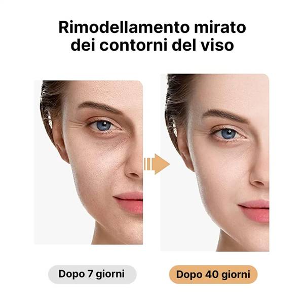 AVILIA RADIOFREQUENZA ANTINVECCHIAMENT0 