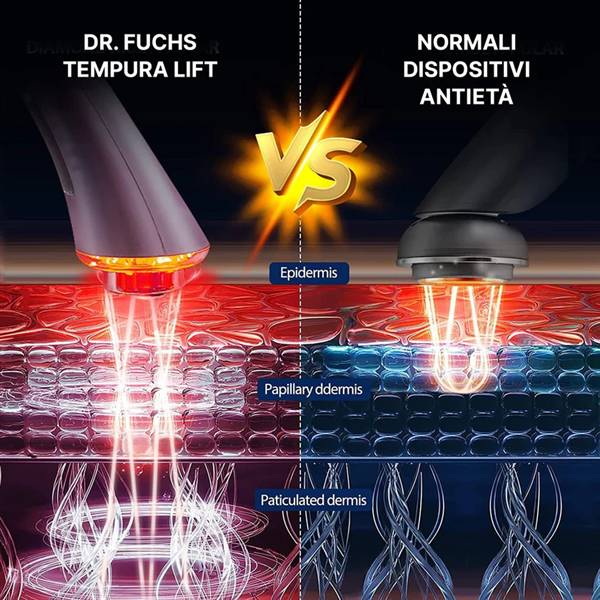 AVILIA RADIOFREQUENZA ANTINVECCHIAMENT0 